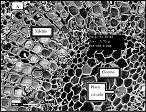 Microscopic view of coffee leaf cells